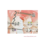 ORTHO MULTI FUNCTION CRIMPABLE HOOK